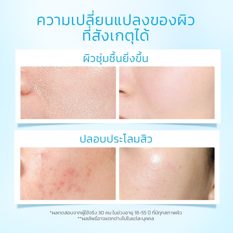 SKINTIFIC 5X Ceramide Barrier Moisturizer Gel บาเรียร์ มอยซ์เจอไรเซอร์ เจล （มอยเจอร์ไรเซอร์ ครีม ครีมทาผิว）