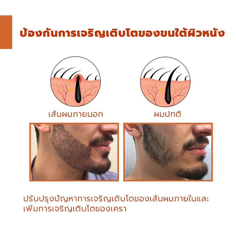 7วันให้ผลอย่างรวดเร็ว🔥เซรั่มปลูกหนวด 30ml น้ำมันหนวด ยาปลูกเครา บำรุงล้ำลึกเร่งการเจริญเติบโตของเส้นผม คิ้ว/ขนตา/เครา