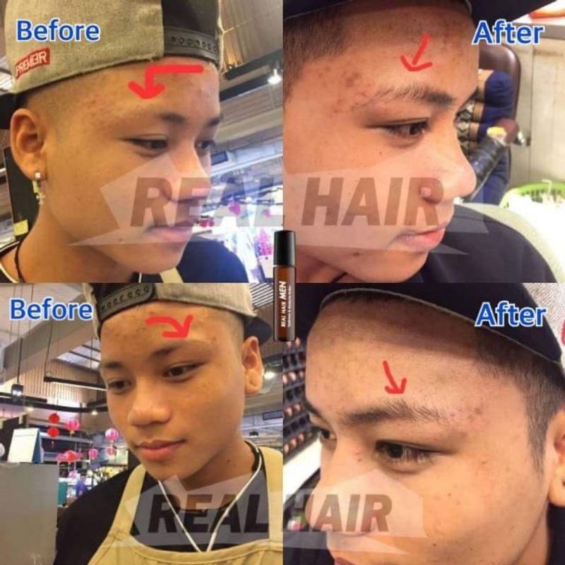 ของแท้!!! Real Hair- เซรั่มปลูกผม คิ้ว หนวด จอน -(สูตรหัวเชื้อ) ใช้ได้ทั้ง ช ญ