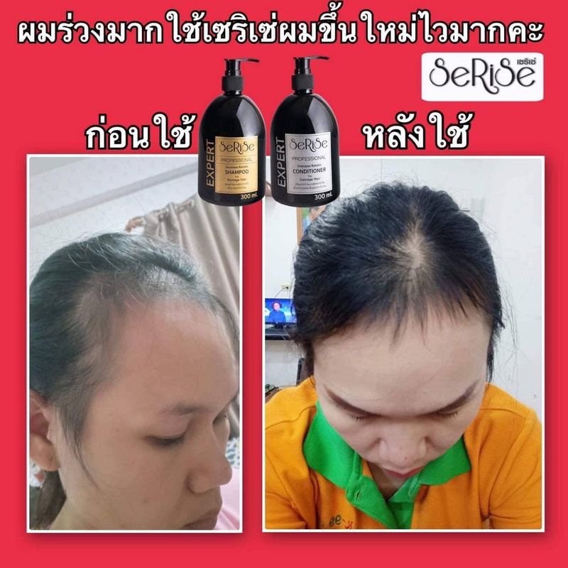 💥ของแท้ พร้อมส่ง ✅แชมพู ครีมนวดผม ทรีทเม้นท์ผม อาหารผม สูตรเคราติน เซริเซ่ บอสปัด เภสัชกร โรงงานผลิต ชุดโปรแอคทีฟ 👍🏻🌈