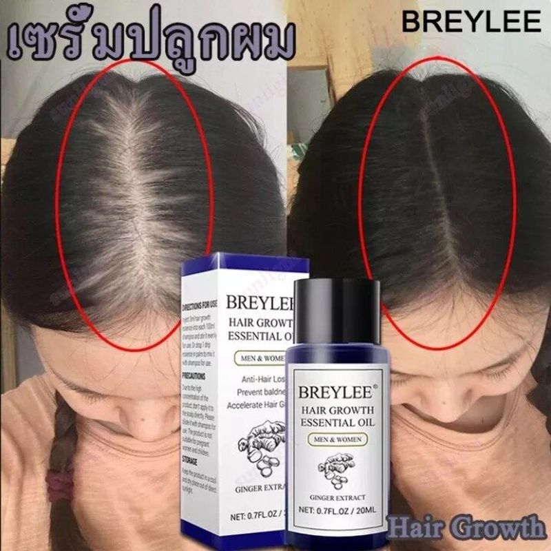 7วัน เห็นผล【พร้อมส่ง】BREYLEE 20ml เซรั่มปลูกผม ฟื้นฟูผมแห้งเสีย แก้ปัญหาผมร่วง ลดผมร่วง บำรุงรากผม ดูแลผม บำรุงผมแห้ง แตกปลาย ป้องกันผมร่วง ทรีนเมนบำรุงผมHair Growth Essential Oil