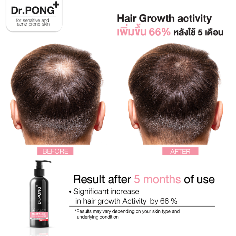 Dr.PONGแชมพูลดผมร่วง เพิ่มวอลุ่ม anti-hairloss shampoo - 2 in 1 shampoo x conditioner ปริมาณ 200 ml