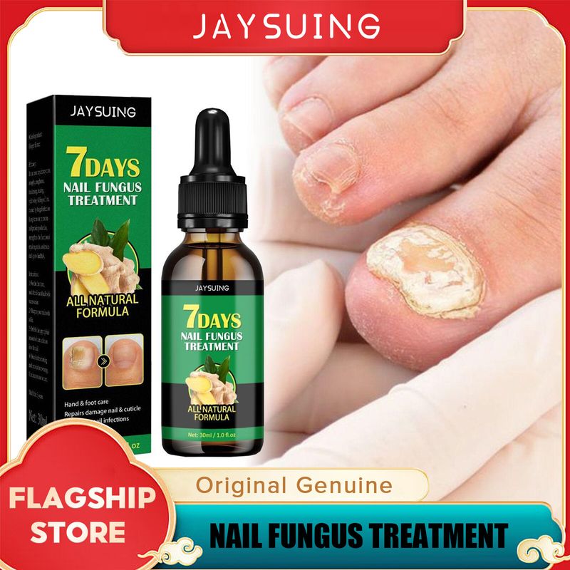 Jaysuing 7วัน Nail Fungus Treatment Essence Serum Nail Repair Treatment Care Hand And Foot Care Removal Repair Anti-Injective Anti-Bacterial Nail Fungal Repair Treatment Serum Onychomycosis Paronychia Anti-Fungal Nail Infection Toe Repair Care(30มล.)