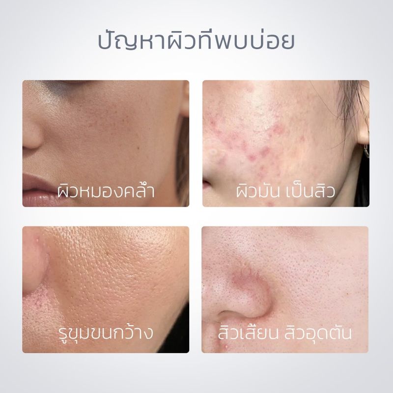 SKINTIFIC โวลคาโน ดีพ พอร์ คลีนซิ่ง เคลย์สติ๊ก (ทำความสะอาดสิวหัวดำและสิวเสี้ยน) Alaska Volcano Clay Mask Stick