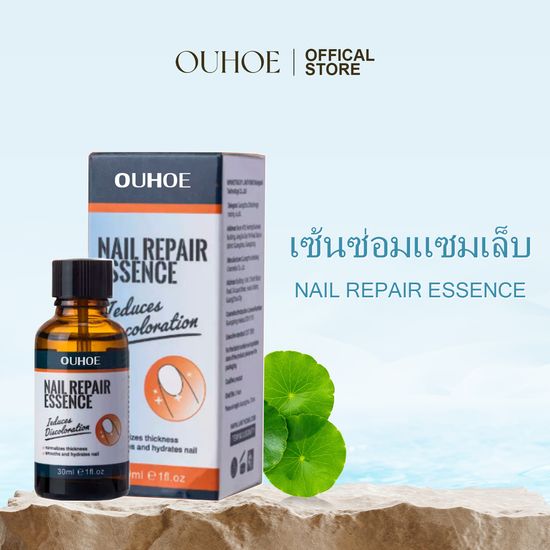 OUHOE เอสเซ้นซ่อมแซมเล็บ Nail Repair Essence เล็บเท้าคุด เอสเซนส์ซ่อมแซมเชื้อราที่เล็บ ทำให้เล็บนุ่ม เล็บหนาขึ้น เล็บเรียบเนียน (30ml)