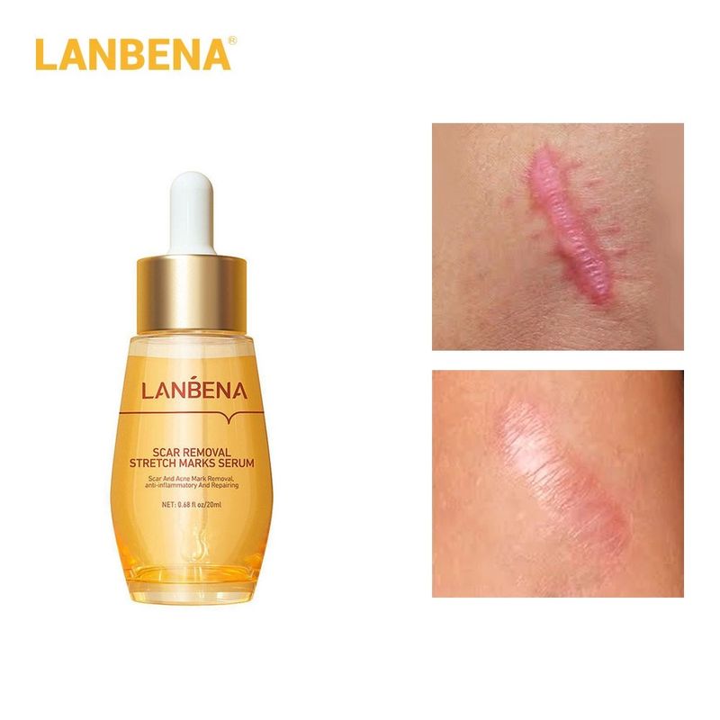 LANBENA Scar Removal Stretch Marks เซรั่มกำจัดรอยแผลเป็น