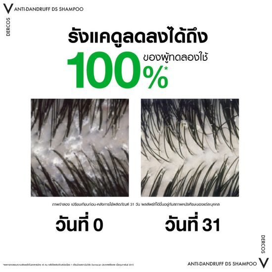 Vichy Dercos Anti-Dandruff Shampoo 200 Ml วิชี่ เดอคอส แอนตี้-แดนดรัฟ แชมพู -สูตรสำหรับผมธรรมดาถึงมัน