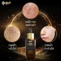 ยันฮี YANHEE ANTI MELASMA SERUM