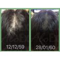 AloEx Black Shampoo 1 ขวดและ AloEx Hair Mask 1 หลอด เซตแชมพูและทรีทเม้นท์บำรุงเส้นผม ลดผมขาดร่วง สำหรับผมแห้งเสีย-ผมทำสี