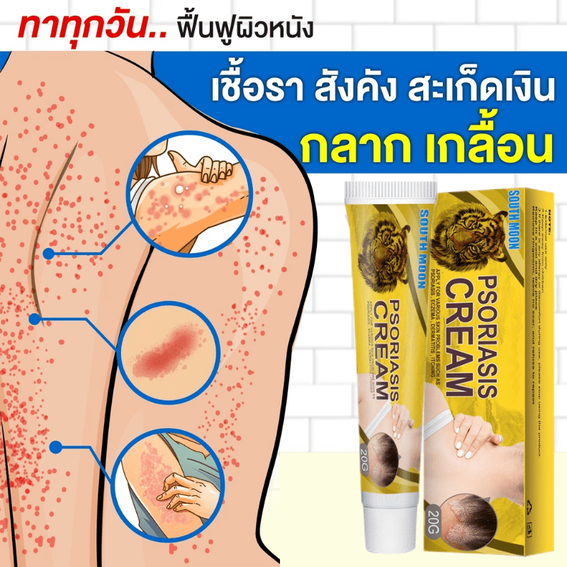 ยาทาแก้คัน แก้คัน ตุ่มเหงื่อ ผื่นผิวหนัง อับชื้น ผด ครีมทาภายนอก Effective Eczema Rash Urticaria Herbal Psoriasis Ointment Desquamation Anti itch Antibacterial