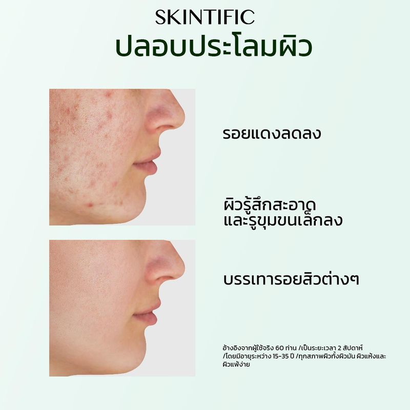 【4PCS】SKINTIFIC โฟมล้างหน้า + มอยเจอร์ไรเซอร์ + เซรั่ม + โทนเนอร์ เซ็ตผิวโกลว์ เซ็ตกำจัดสิว เซ็ตชะลอวัย เซ็ตผิวอิ่มน้ำ